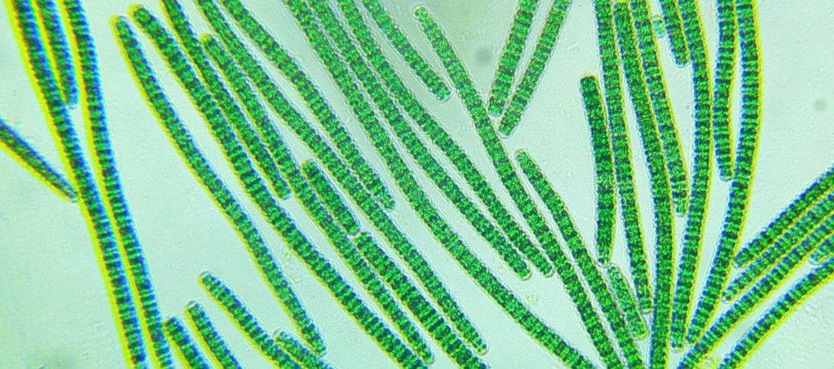 Клетки водорослей и цианобактерий. Цианобактерии сине-зеленые водоросли. Синезеленые цианобактерии. Фотосинтезирующие цианобактерии. Нитчатые цианобактерии.
