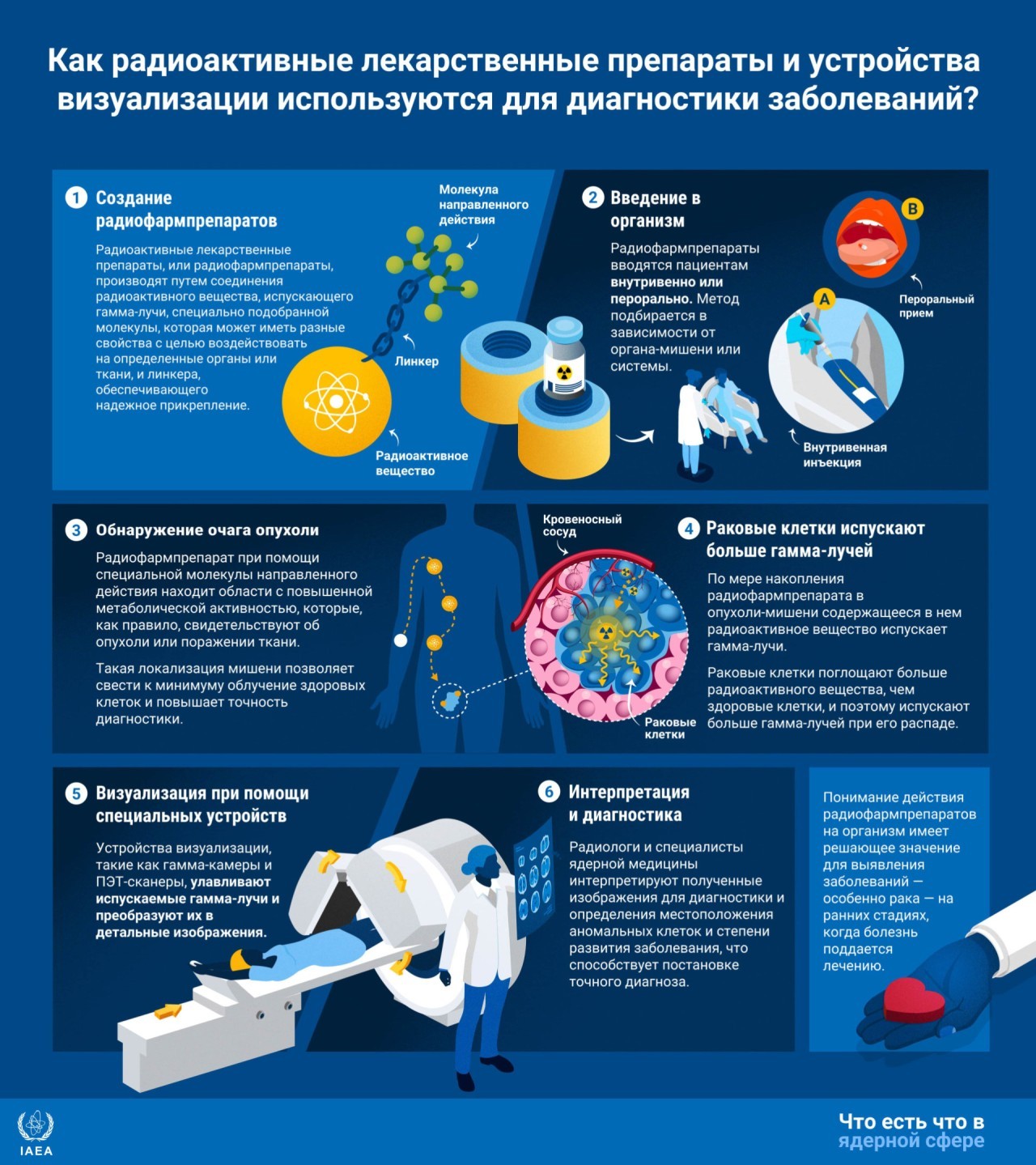 Излучение (поток гамма-квантов), которое испускают диагностические радиофармпрепараты, называется фотонным. Оно способно проникать в органы человека, после чего внешняя камера обнаруживает излучение и формирует изображение МАГАТЭ
